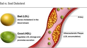 Good and Bad Cholestrol